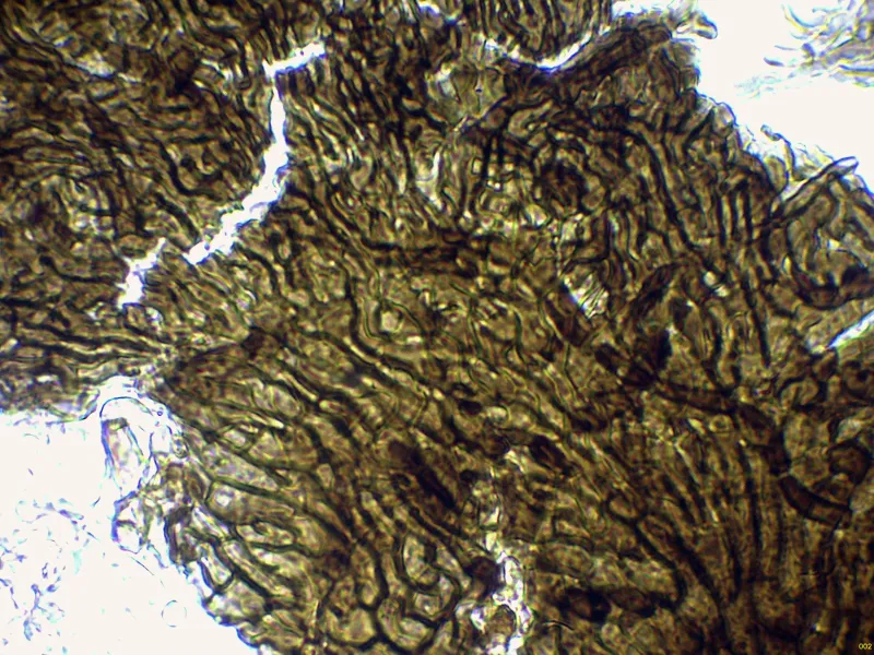 Arnaudiella genistae 10 - Peridio agua-002